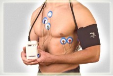 Суточное мониторирование артериального давления (СМАД) 